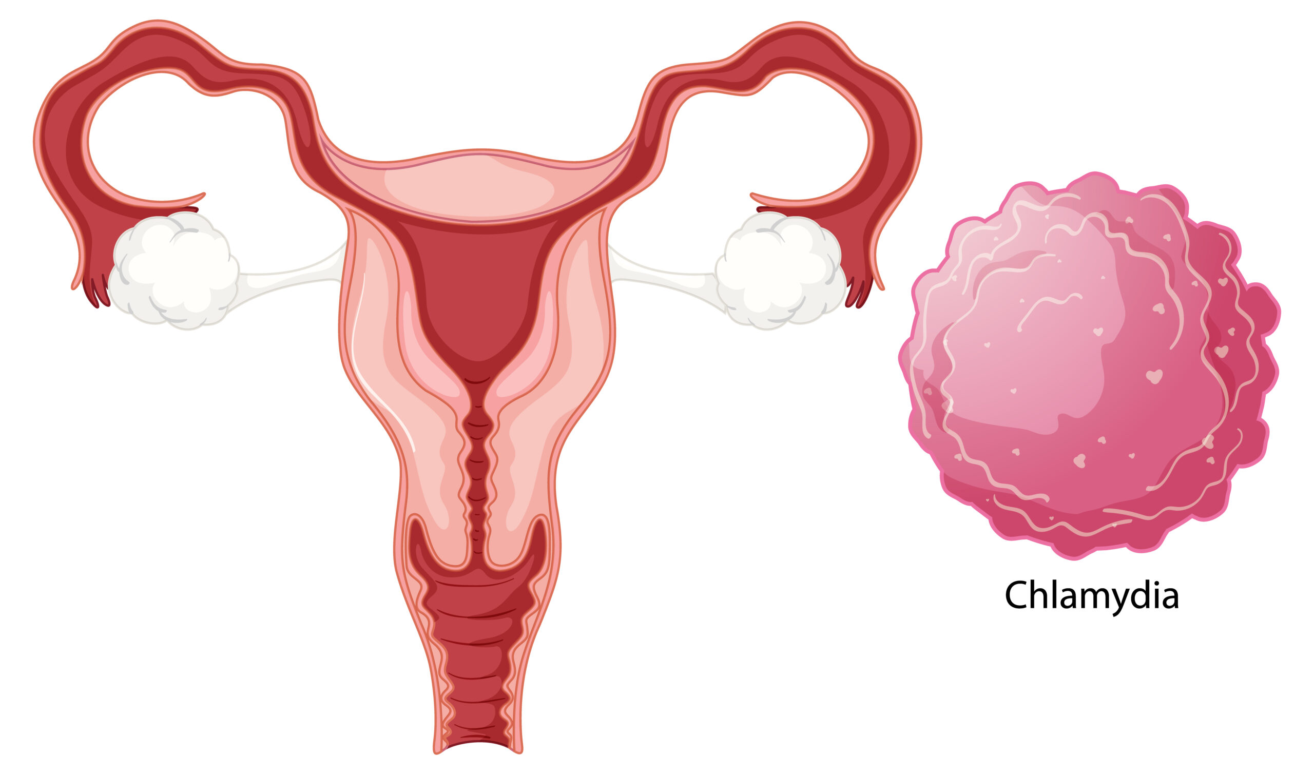 Vaginal infection bacteria concept illustration